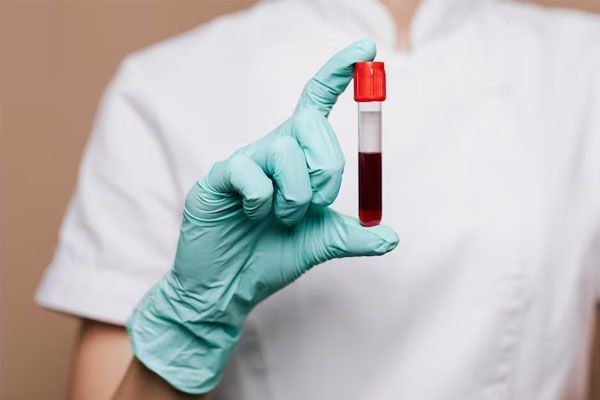 Chirurgo che tiene l'analisi del sangue