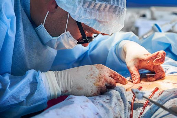 medico maschio che posiziona i punti di sutura dopo la procedura