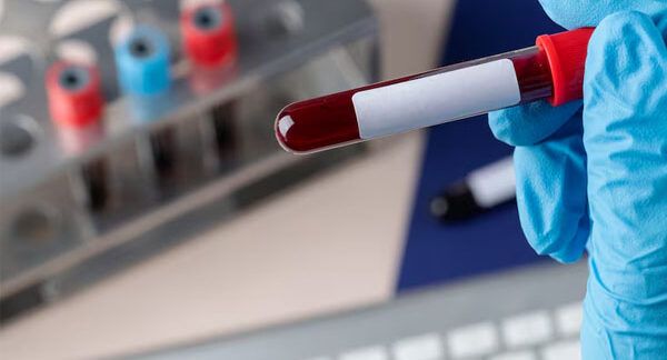 reparti di ematologia in Turchia
