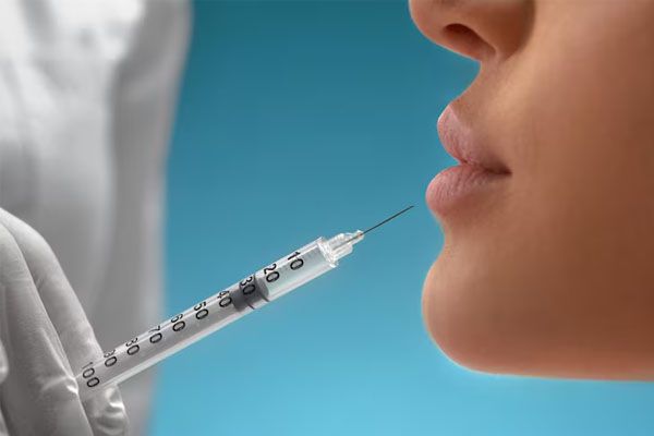 iniezione di Botox cosmetico nelle labbra